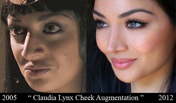 клаудия линкс до и после операции смотреть фотографии модель иранская актриса